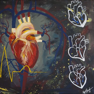 An artistic drawing of the heart with arteries.